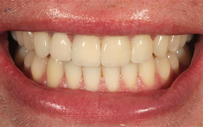After treatment at Chroma Dental