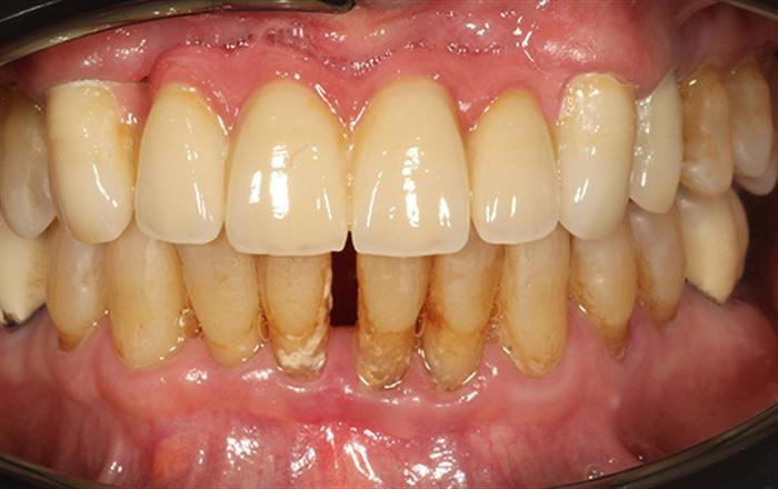 After treatment at Chroma Dental